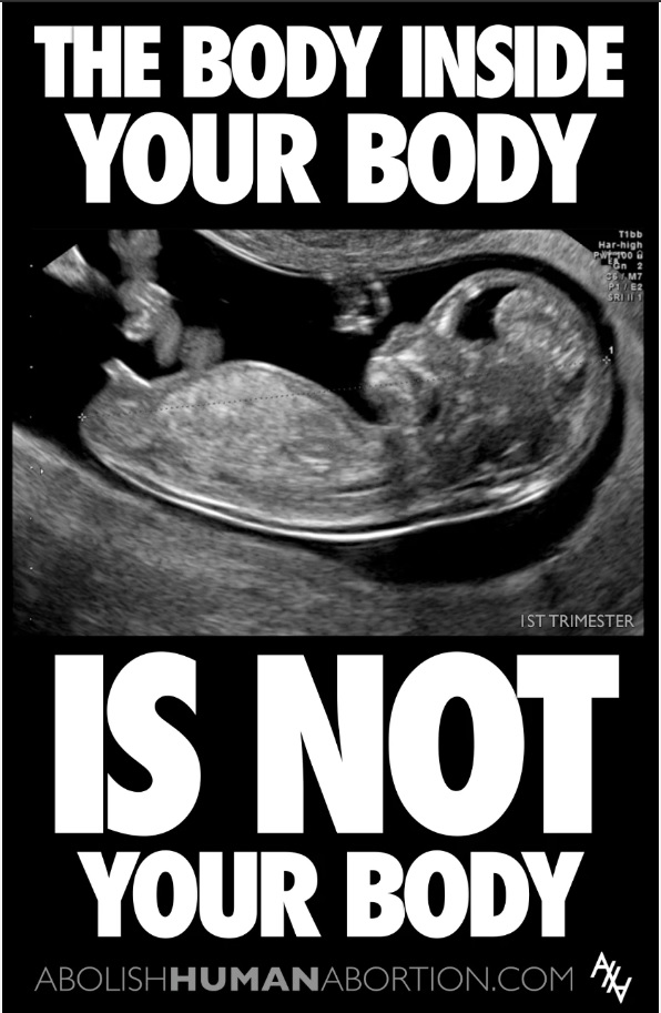 Meme of the day: Stop All The Killings! Do Something About ABORTION! - The Daily Report